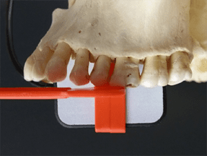 Figure 1 - Better mesial imaging area captures canine/premolar contact