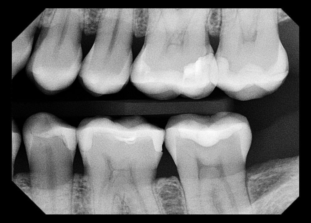 XDR Dental Imaging