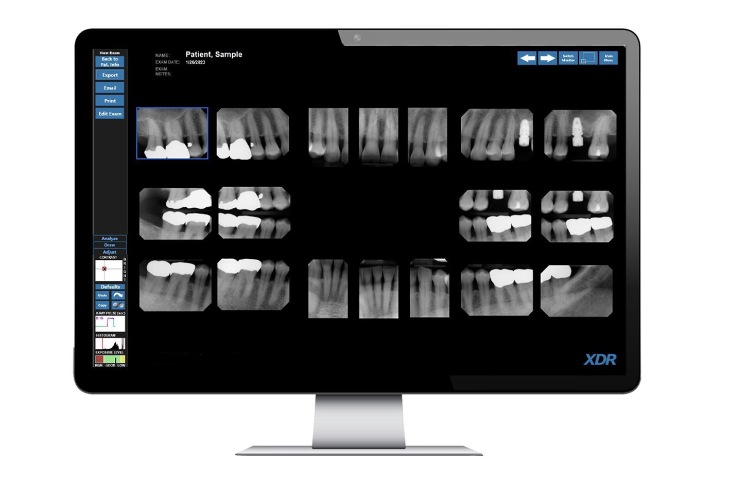 New XDR Imaging Software