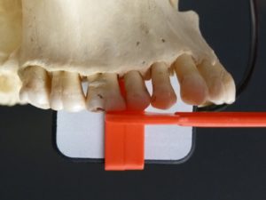 Figure 1 - Capture of Canine-Premolar Contact